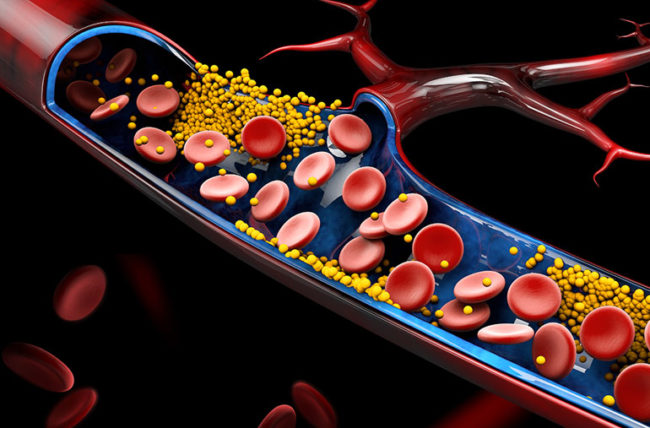 Are they Harmful or Beneficial? Recent study outcomes of using Statins