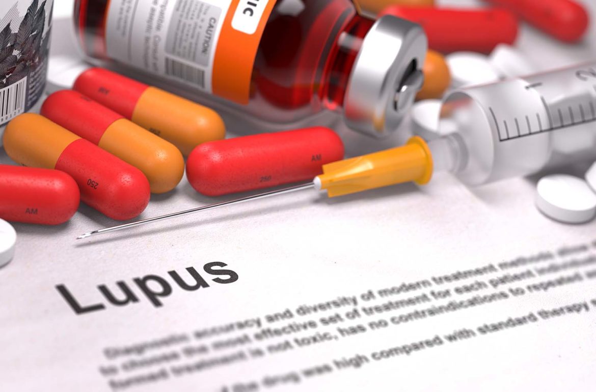 AstraZeneca’s mAb Saphnelo scores FDA Approval for the treatment of Lupus